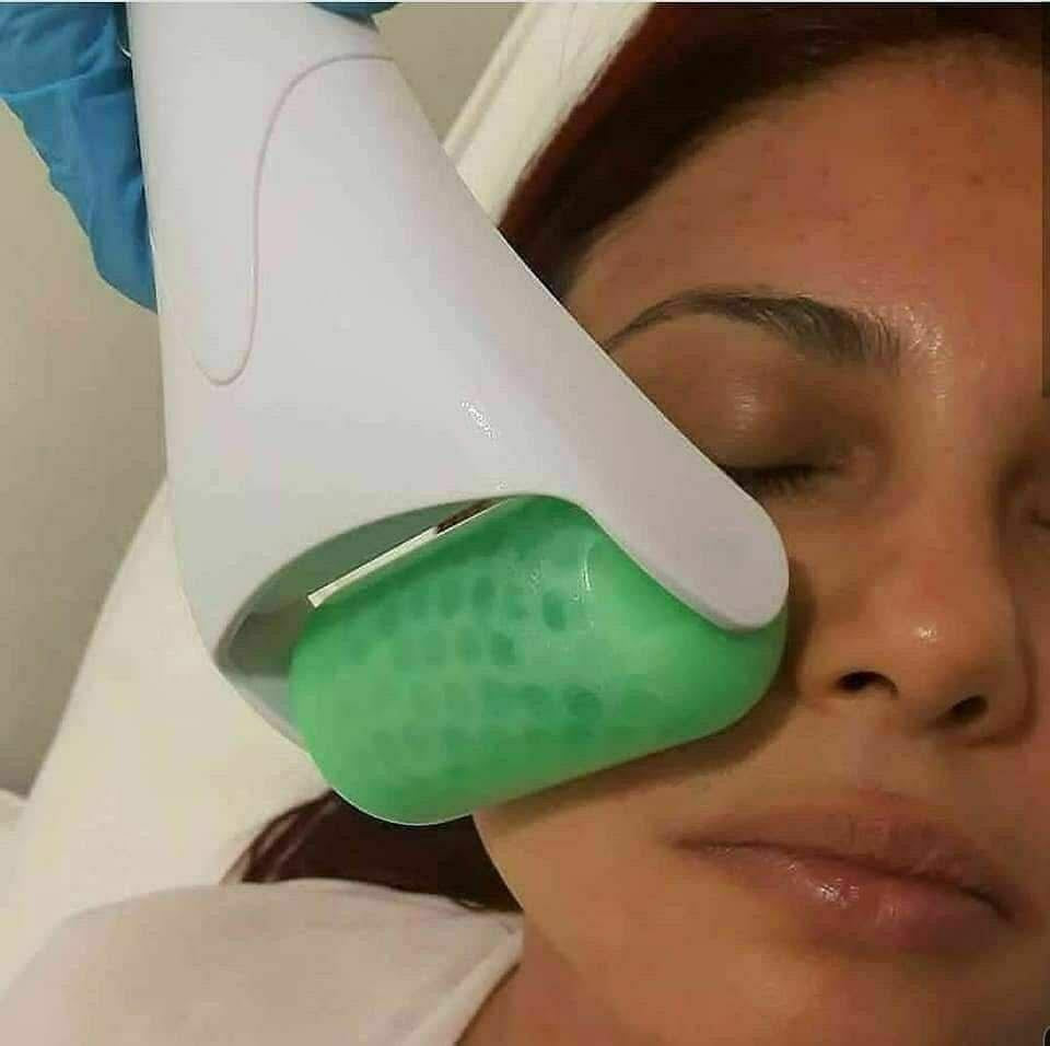 Facial Ice Roller